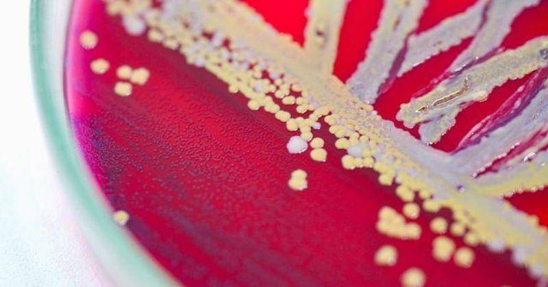 Criver.com/ Bacillus Cereus